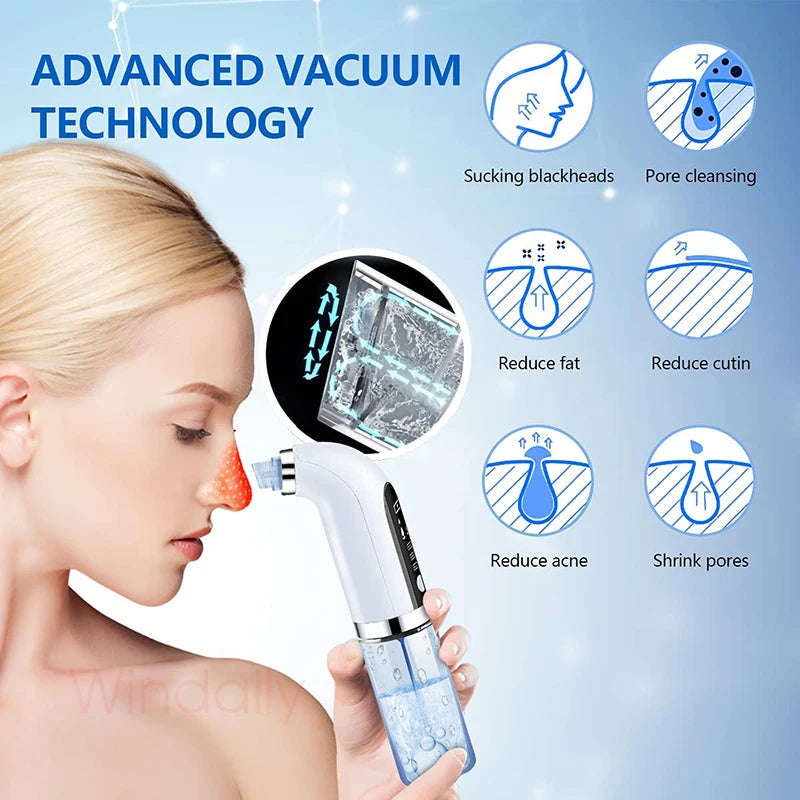Blackhead Remover - Electric Pore Vacuum, USB Rechargeable Cleaner